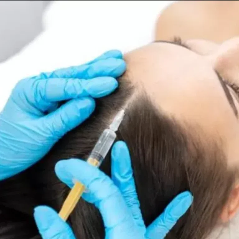 mesotherapy-1024x575-1.png